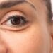 under eye wrinkles - jojoba oil for under-eye wrinkles