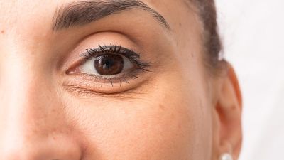 under eye wrinkles - jojoba oil for under-eye wrinkles 